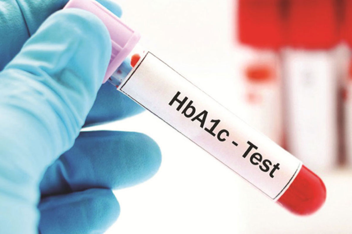 HbA1C test 032421